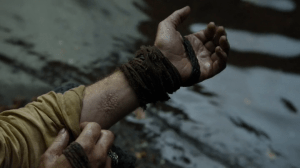 Jorah should probably get that looked at and stop picking at it.