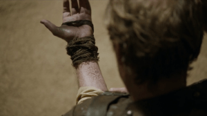 Jorah should definitely stop picking at this.